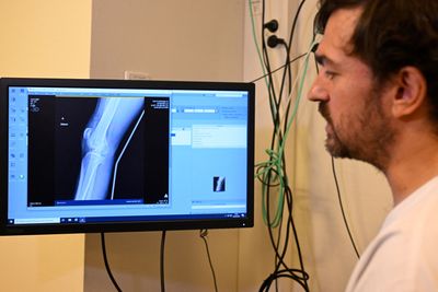 Stanford Scientists Reversed Arthritis and Regrew Cartilage by Blocking an Aging Protein — and It Worked in Human Tissue Too