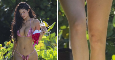 After Viral Post Claims Kylie Jenner’s Knees Give Away Plastic Surgery, Surgeon Weighs In