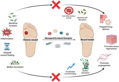 A new nanotech breakthrough could help heal dangerous wounds antibiotics can’t treat