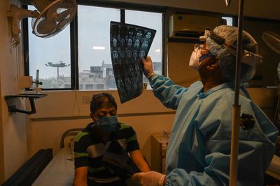 Scientists Scanned the Brains of Long COVID Patients for Inflammation — The Results Were Not What They Expected