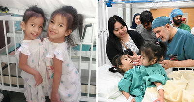 2-Year-Old Conjoined Twins Successfully Separated Following Grueling Six-Hour Surgery