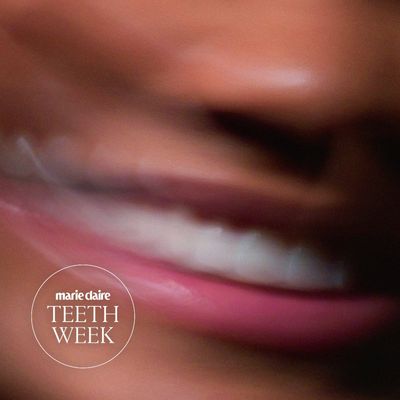 The Demand For Veneers Has Never Been Higher. Neither Has the Regret