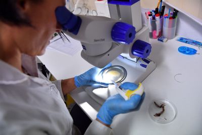 Nature Communications: Declining Phosphatidylcholine Drives Mitochondrial Aging — and Restoring It Reversed the Decline in Worms Within 2 Days