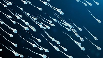 Diagnostic dilemma: Woman's infertility may have been caused by rare semen allergy