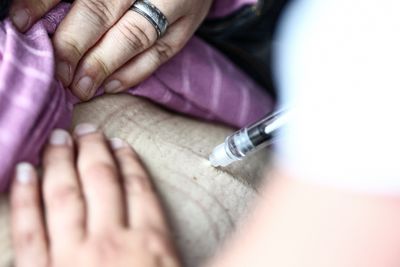 ENDO 2026 Study Finds Most People Who Stop Ozempic or Tirzepatide for Type 2 Diabetes Eventually Restart Treatment