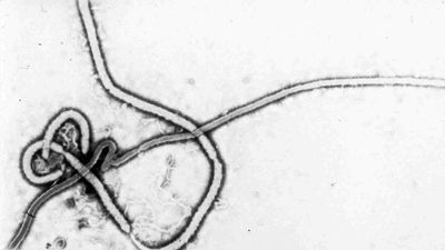 France confirms first Ebola case in doctor returning from DR Congo mission