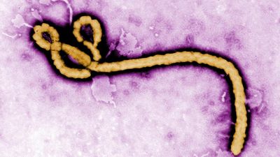 France announces first Ebola case in doctor returned from DR Congo