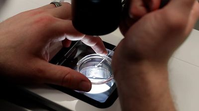Costly IVF add-ons fail to show benefits, new study finds
