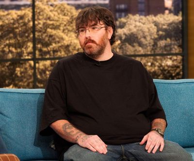 US man who claims to have world’s smallest penis launches fundraiser for enlargement surgery