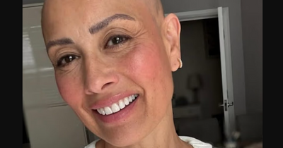 'Two-Thirds Bald' But 'Vibrating High': How Melanie Sykes Turned PTSD‑Linked Alopecia Into a Post‑Traumatic Growth Story