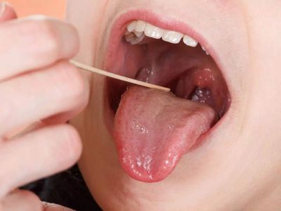 Sore throat or tonsillitis? Symptoms, causes, why infections keep coming back and new treatment options explained