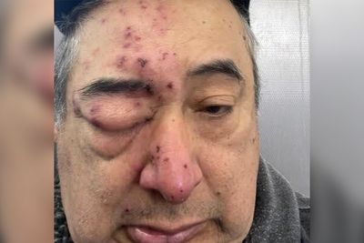 Chicago man woke up in his home with rat ‘chewing on his face’ after complaining about infestation