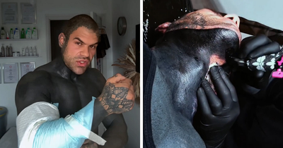 Man Covered In Blackout Tattoos Reveals Harsh Truths He Wishes He’d Known Before Diving Into The Trend