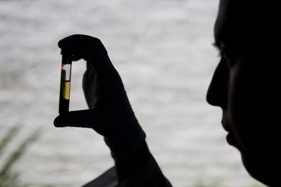 The FDA Approves the First-Ever Hepatitis Delta Treatment: Here's Why Hepatitis B Patients Should Get Tested