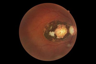 Cat parasite infecting third of humans is ‘major cause of vision loss’, scientists warn