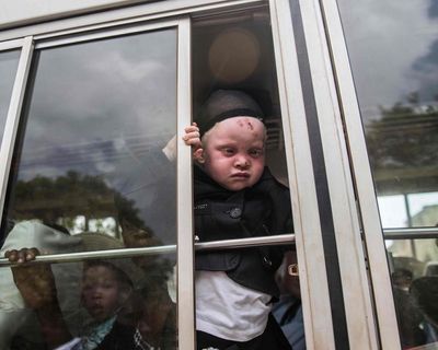 ‘I was devastated’: the Nigerian with albinism deported under Trump’s asylum crackdown