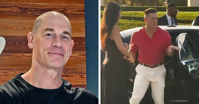 John Cena Shocks With Hair Transplant Reveal After Being Caught Having Trouble Walking