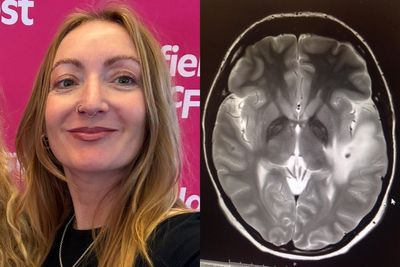 I came back from India with a metre-long tapeworm and 38 brain parasites – doctors didn’t know what to do