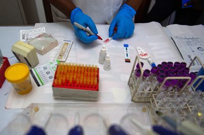 HIV-Positive Patients Face a Much Higher Risk of Anal Cancer, Study Finds