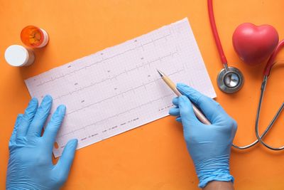 Trajectory Over Threshold: Dr. Marlow Hernandez's Scientific Contribution to Heart Failure Care