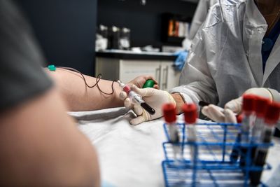 The New Blood Test for Colon Cancer Has One Major Limitation Doctors Say Patients Must Understand Before Choosing It