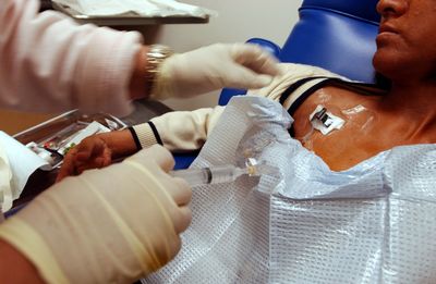 Tuberculosis Cases in the U.S. Just Hit a Multi-Decade High: Public Health Experts Are Alarmed
