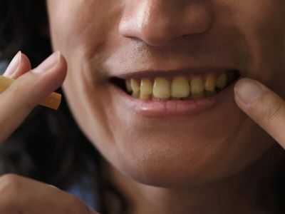 Less invasive oral cancer treatment: New IISc Bengaluru study finds ultrasound selectively kills tumor cells while sparing healthy ones