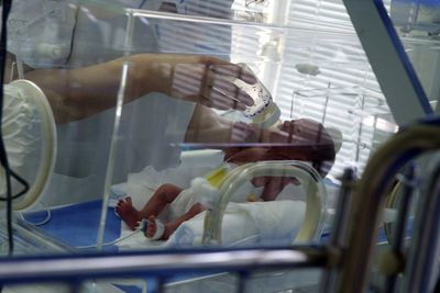 Premature Infants in NICUs Face a Higher Risk of NEC from Formula, Experts Warn