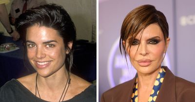 15 Before-And-After Photos Of Celebrities Who Couldn’t Stop Getting Plastic Surgeries