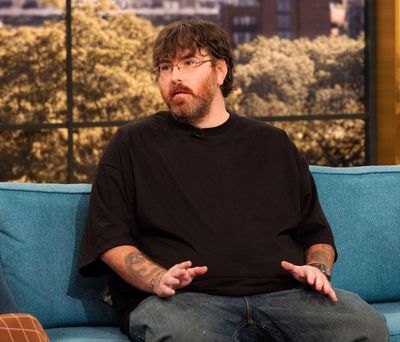 Man claiming world’s smallest penis says he’s booked enhancement surgery after public’s help