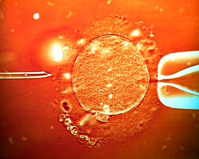 UK-based couple say overseas surrogacy agency made twins using wrong sperm