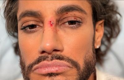 Frankie Grande suffers concussion after on stage accident in Titanique