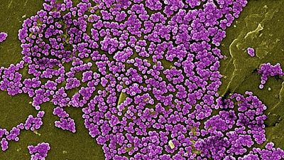 Scientists find new way to fight antibiotic-resistant bacteria
