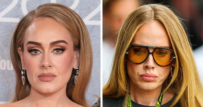 Plastic Surgeon Intervenes After Adele’s Appearance At Rare Public Outing Turns Into Viral Discussion