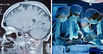 Man’s Suspected Brain Cancer Turns Into A Horror Story As Medical Team Uncovers Something Far Creepier
