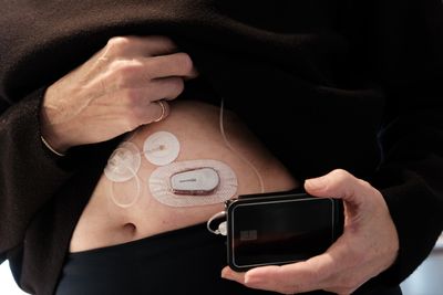 The FDA Just Cleared the First Over-the-Counter Glucose Monitor for Children