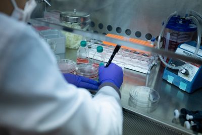 Medicaid Will Cover Sickle Cell Gene Therapy, but Only When It Actually Works for the Patient