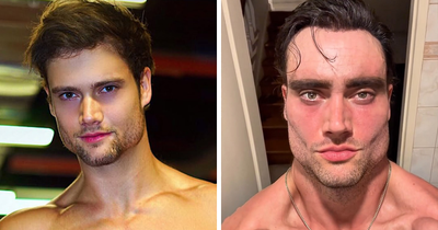 After Lookmaxxer’s Bizarre Passing At 32, His Extreme Transformation Stuns Many