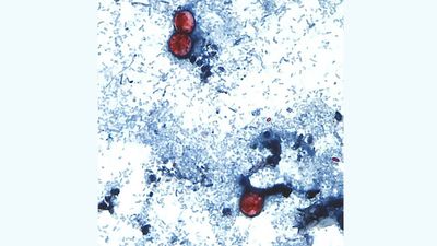 Nearly 1,000 cyclospora cases reported in Michigan in largest-ever parasite outbreak