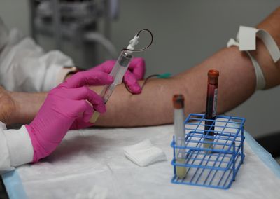 Your Blood Can Now Reveal How Much Ultra-Processed Food You Eat