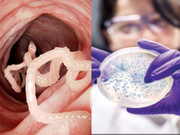 What is Cyclospora? Diarrhea-causing parasite behind biggest US outbreak explained: Symptoms, causes, treatment and prevention