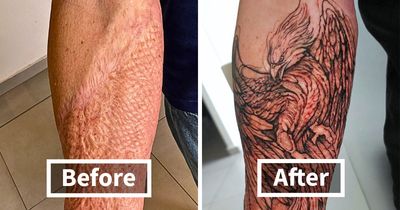 30 Scar Cover-Up Tattoos By Elvira Bono That Help People Feel Comfortable In Their Skin Again