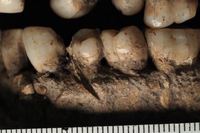 Man from 100,000 years ago may be earliest victim of stabbing in face