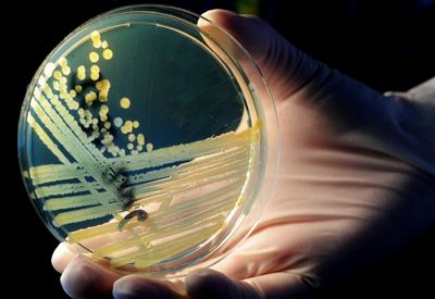 FDA Tracking New E. coli O157:H7 Outbreak with 14 Confirmed Cases and No Food Source Identified Yet