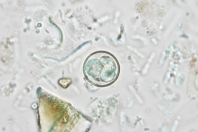 Cyclospora Cases Are Rising Across the US—Why Health Officials Are Struggling to Trace the Source