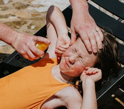 Help, my sunscreen stings! What should I do?