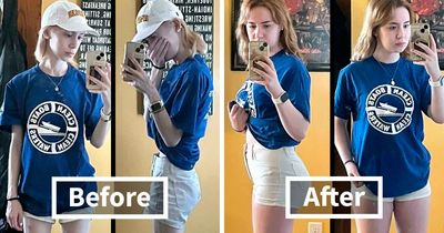 90 Of The Most Interesting “Before And After” Photos Of How People Changed
