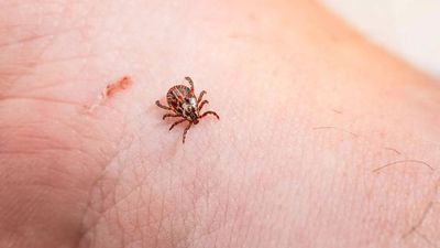 Anaplasmosis, a new tick-borne disease is rising in Canada and here’s why doctors are concerned