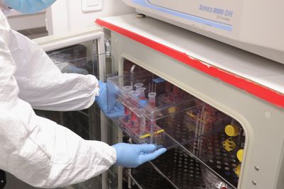 Can Removing "Zombie Cells" Slow Aging? Human Clinical Trials Are Starting to Deliver Answers
