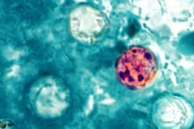 Cyclospora Mode of Transmission: How the Parasite Is Spreading Across the US, Causing 'Explosive Diarrhoea'
